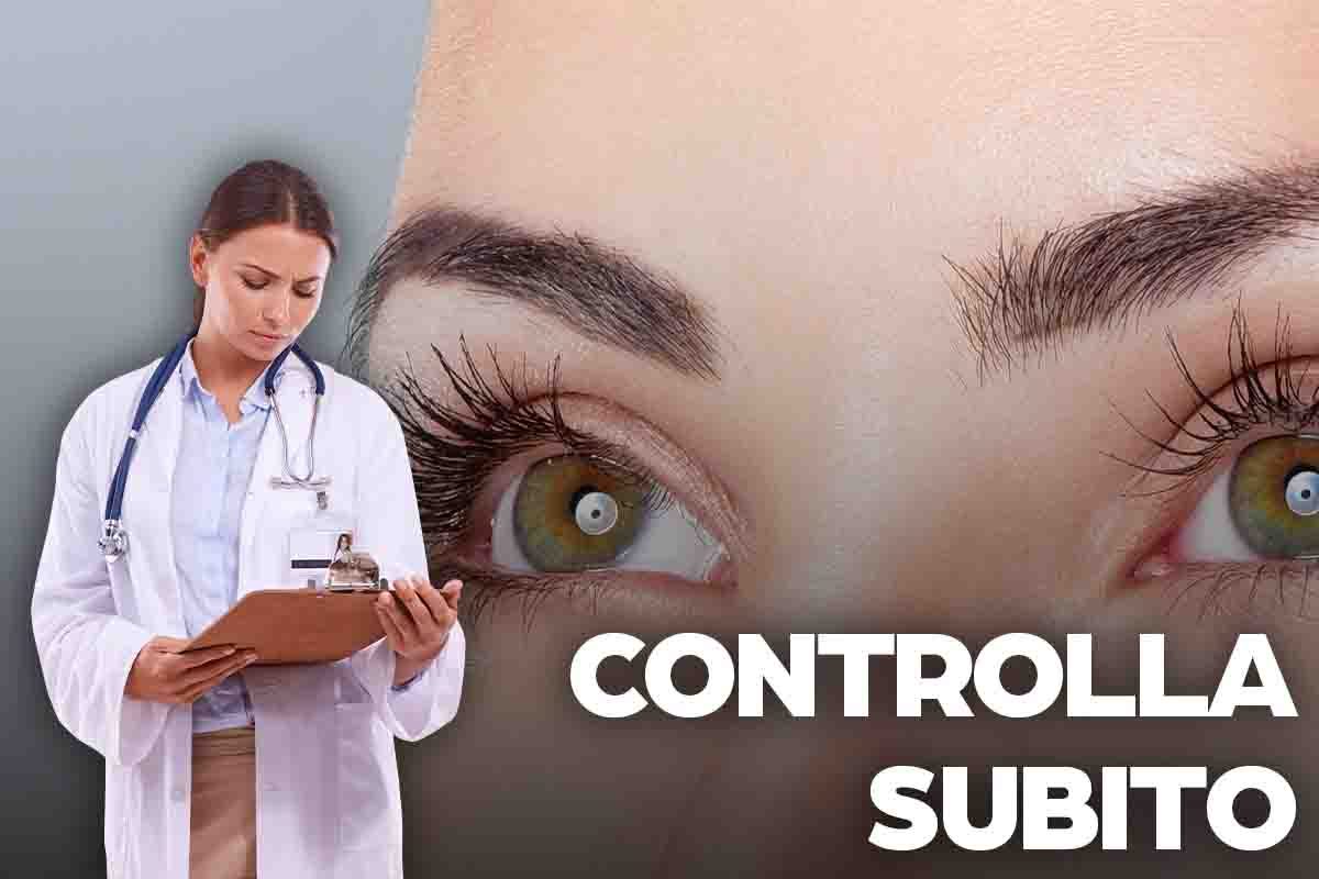 Controlla i tuoi occhi: possono rivelare la presenza di una seria malattia