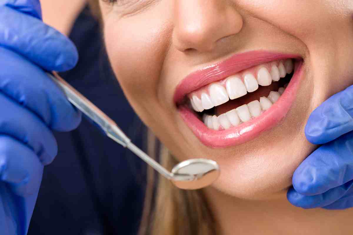 Denti bianchi, rimedi naturali o dentista