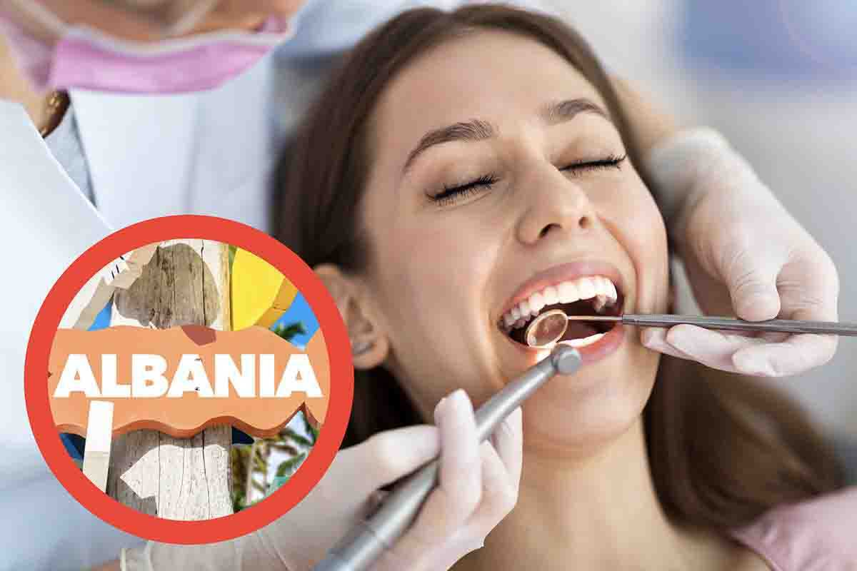 Dentista in Albania, quanto conviene